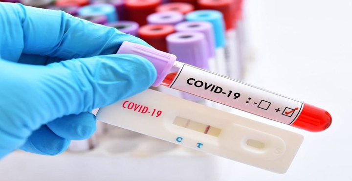 COVID-19